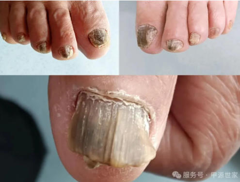 ��ָ�ױ�Ӳ�������β��ܣ�ֻ��Խ��Խ���أ�����