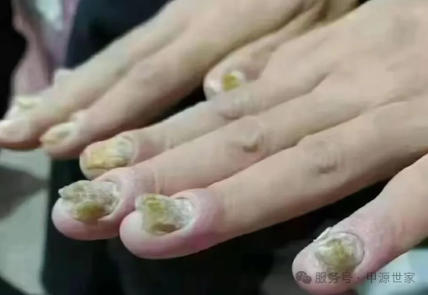 ��ָ�ײ����£����µ���һ�����ϡ�