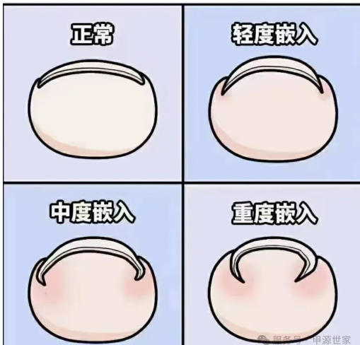 �׹����ܷ��������ؼ��������س̶ȡ�