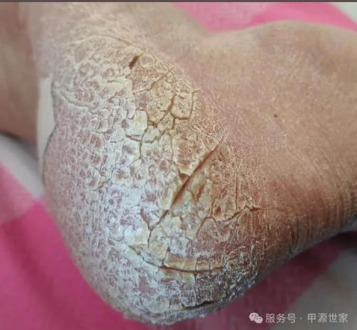 �ź��Ƶ�����ѣ���������ֻ�����ϼ�����